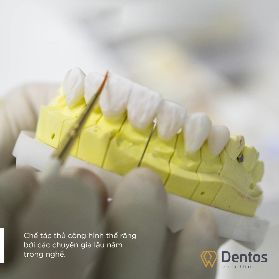 Tạo hình và tô màu lớp men sứ Orodent bên ngoài